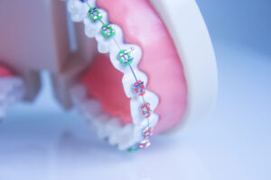 Orthodontie